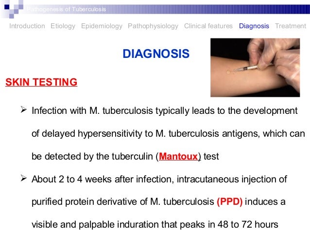 utbrändhet symtom test utbrändhet symtom test